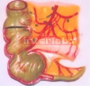 MAGNIFIED VERMIFORM APPENDIX AND CAECUM MODEL